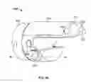 Fig. 09 - Circuit Board Assembly of A Multiple Viewing Elements Endoscope