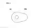 Fig. 09 - Length adjustable cannula