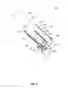 Fig. 09 - Minimally obstructive retractor for vaginal repairs