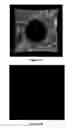 Fig. 02 - Non-invasive ocular analyte sensing system