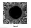 Fig. 06 - Non-invasive ocular analyte sensing system
