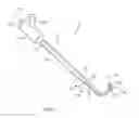 Fig. 02 - Systems and methods for performing medical procedures involving accessing the lymphatic system
