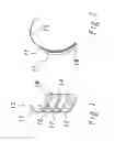 Fig. 02 - DEVICE AND METHOD FOR ANALGESIC IMMOBILIZATION OF FRACTURED RIBS
