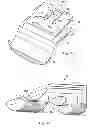 Fig. 07 - Single lock external fixation clamp arrangement and method