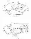 Fig. 09 - Single lock external fixation clamp arrangement and method