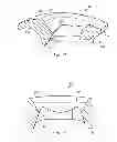 Fig. 10 - Single lock external fixation clamp arrangement and method