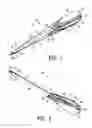 Fig. 02 - Apparatus and method for securing tissue