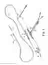 Fig. 02 - CONTROLLER FOR AN ATHERECTOMY DEVICE