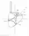 Fig. 01 - Restricted expansion dissector
