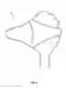 Fig. 04 - Restricted expansion dissector