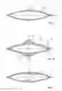 Fig. 07 - Restricted expansion dissector