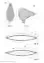 Fig. 08 - Restricted expansion dissector