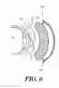 Fig. 07 - NOVEL METHODS AND DEVICES FOR THE THERAPEUTIC TREATMENT OF MYOPIA