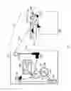 Fig. 02 - System for dynamically adjusting treatment angle under tension to accommodate variations in spinal morphology