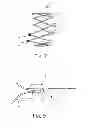 Fig. 06 - Protuberant aneurysm bridging device and method of use