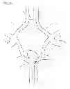 Fig. 09 - Protuberant aneurysm bridging device and method of use