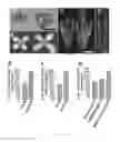 Fig. 03 - Methods of controlling seed size in plants
