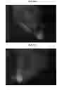 Fig. 22 - Polysaccharide synthases