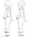 Fig. 14 - Garment