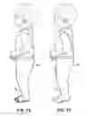 Fig. 16 - Garment