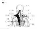 Fig. 10 - Clothing