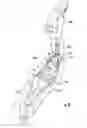 Fig. 06 - Field stretcher