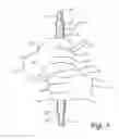 Fig. 04 - Hand stabilizer