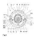 Fig. 04 - Device for treating a thread