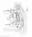Fig. 02 - Cutting tool assembly for HVAC vent opening and the like