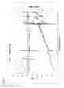 Fig. 18 - Process for producing geothermal power, selective removal of silica and iron from brines, and improved injectivity of treated brines