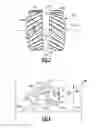 Fig. 04 - Turbine engine gearbox