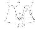 Fig. 01 - Gear