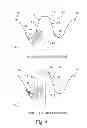 Fig. 04 - Gear