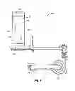 Fig. 08 - Transfer mechanism for use with a food processing system