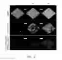 Fig. 03 - Composition and method for reducing bacterial biofilm formation in connection with a dental procedure