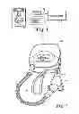 Fig. 02 - Ventless mask CPAP system