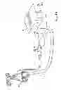 Fig. 04 - Ventless mask CPAP system