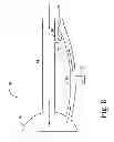 Fig. 08 - Ventless mask CPAP system
