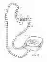 Fig. 11 - Ventless mask CPAP system