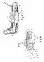 Fig. 12 - Ventless mask CPAP system