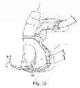 Fig. 14 - Ventless mask CPAP system