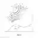 Fig. 07 - ORAL AIRWAY