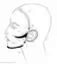 Fig. 01 - Facial structure stabilization methods and apparatus