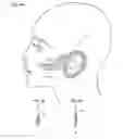 Fig. 04 - Facial structure stabilization methods and apparatus