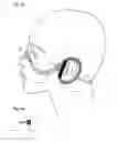 Fig. 06 - Facial structure stabilization methods and apparatus