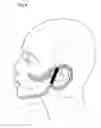Fig. 10 - Facial structure stabilization methods and apparatus