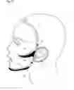 Fig. 12 - Facial structure stabilization methods and apparatus