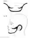 Fig. 13 - Facial structure stabilization methods and apparatus