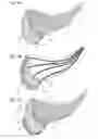 Fig. 14 - Facial structure stabilization methods and apparatus