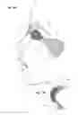 Fig. 17 - Facial structure stabilization methods and apparatus